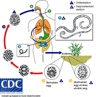 ascariasis cdc.jpg