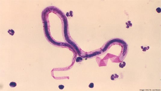 Filariasis parasitt