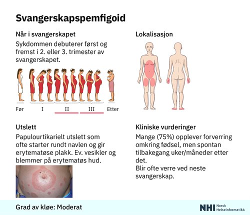 Illustrasjon som viser egenskaper ved svangerskapspemfigoid