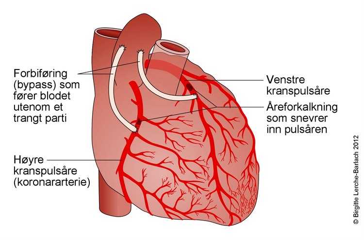 Anatomik bogichlar Anatomik bogichlar