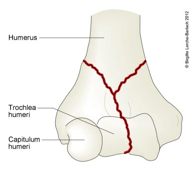 7324-2-fraktur-transkondyler-humerus2.jpg