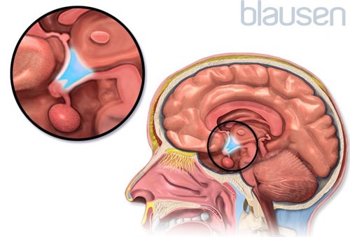 Hypothalamus og hypofyse