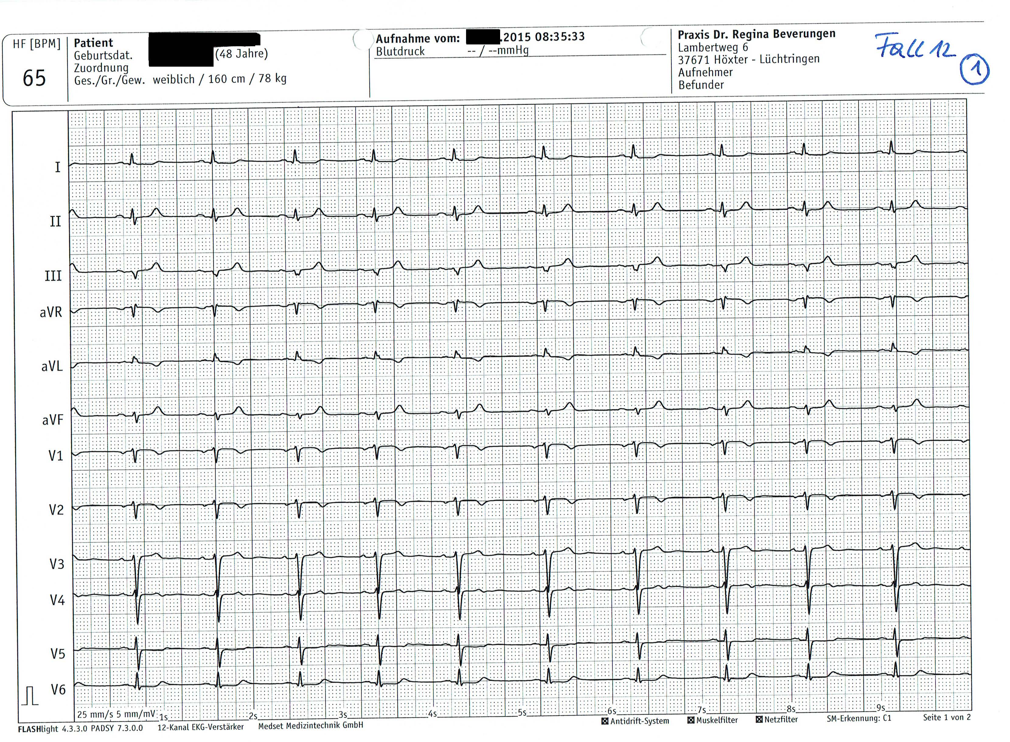 EKG_Prüfungsfragen_1.jpg