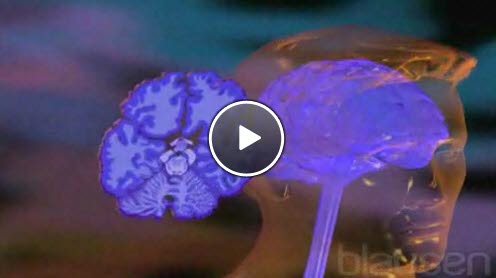 Alzheimers sykdom