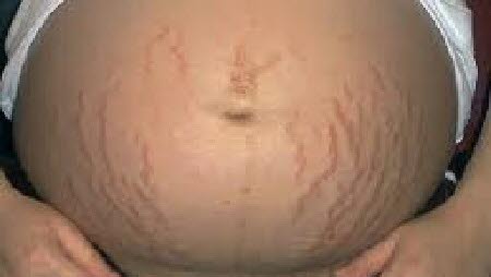 Mens og gravid Mens og gravid
