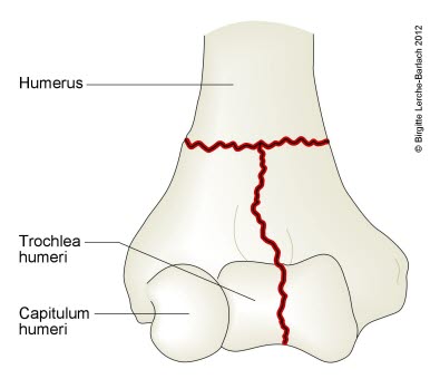 7323-2-fraktur-transkondyler-humerus.jpg