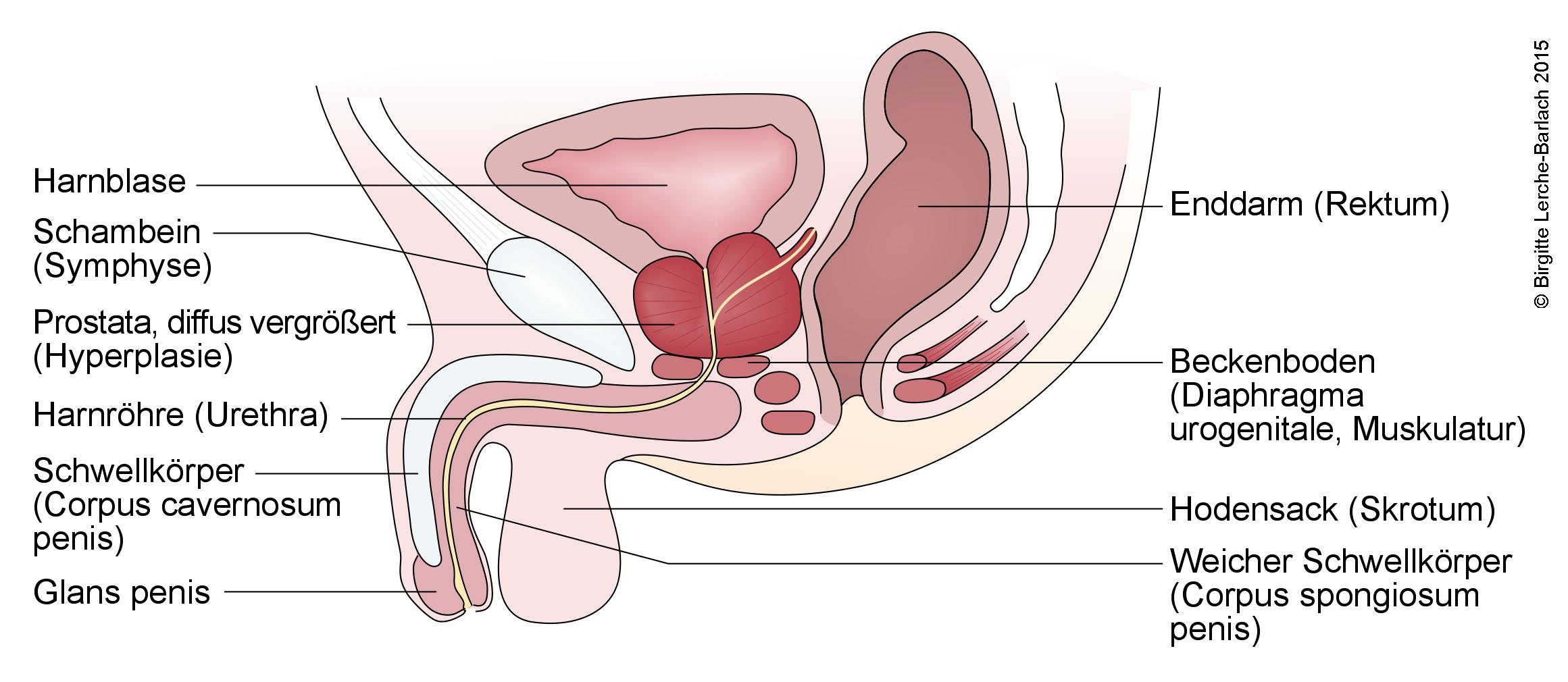 Männliche Geschlechtsorgane bei Prostatahyperplasie