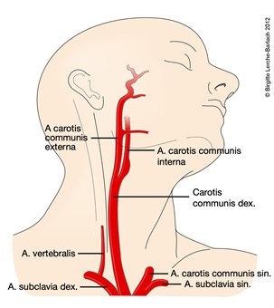 6710-2-arteria-carotis.jpg