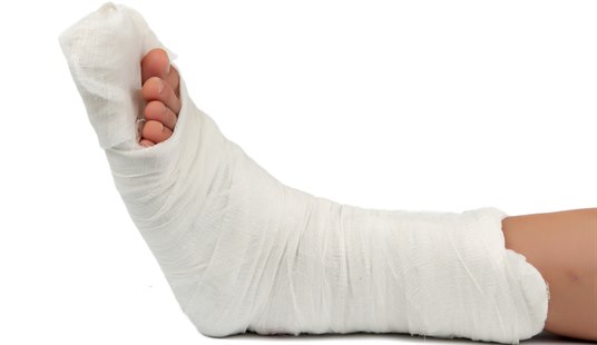 Gipsbehandling og mulige komplikasjoner - NHI.no