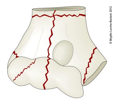 9229-2-id8180-humerus-distale.jpg