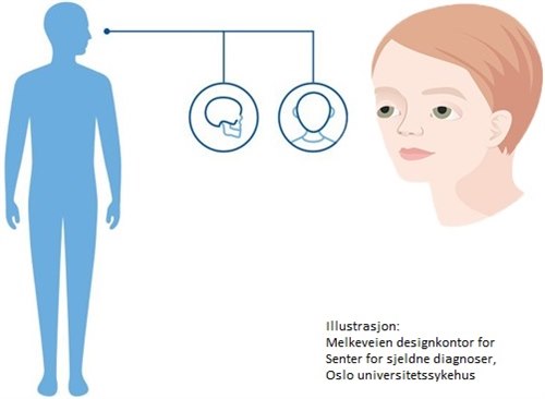 Muenke syndrom