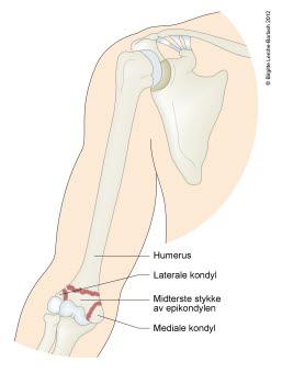 7325-2-fraktur-transkondyler-humerus-hele-overarme.jpg