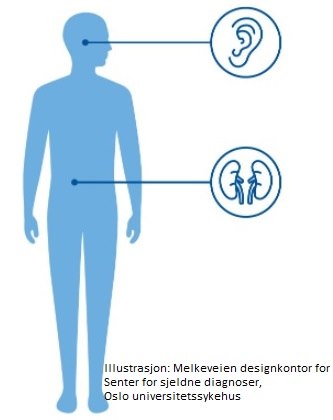 Alports syndrom